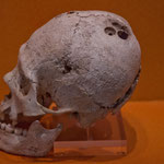 ....die Köpfe der Kleinkinder wurden verformt - ähnlich der Ägypter.